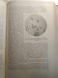 Нервные болезни; Е. К. Сепп, М. Б. Цукер, Е. В. Шмидт; 1950 г., фото №9