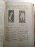 Нервные болезни; Е. К. Сепп, М. Б. Цукер, Е. В. Шмидт; 1950 г., фото №10