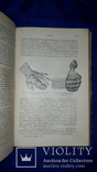 1911 Общая хирургия в 2 томах, фото №4