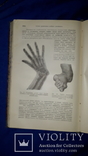 1911 Общая хирургия в 2 томах, фото №5