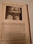 1933 Кожные болезни П. Григорьев, фото №2