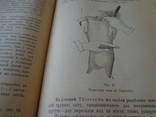 Курс хирургической терапии 1902 год., фото №10
