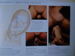 Книга о зачатии беременности ., фото №10