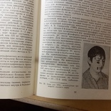 Мочерет "Рефлексотерапия в лечении нервной системы" 1989р., фото №6