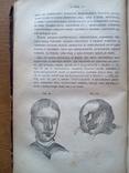 Пластические операции хирургия 1886 С иллюстрациями, фото №7