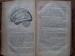 Пластические операции хирургия 1886 С иллюстрациями, фото №10