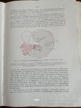Акушерство и Гинекология на немецком 1920 года, фото №12