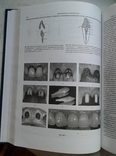 Ортопедическая Стоматология. Аболмасов Н., фото №5