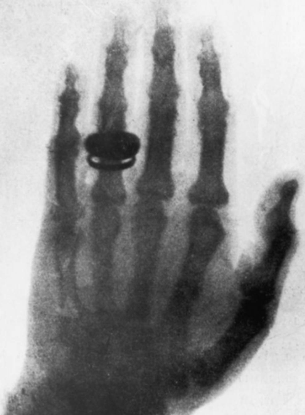 On the first X-ray was the hand of the scientist's wife