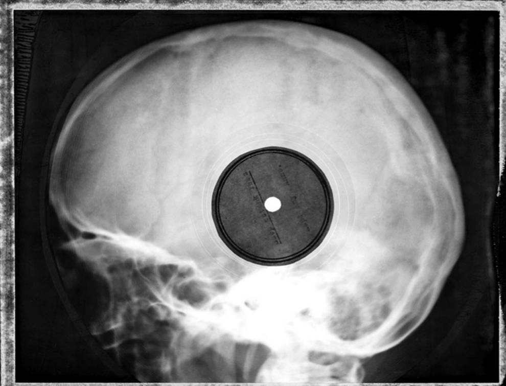 Музика на кістках: як на рентгенівських знімках записували західну музику
