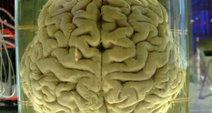 Колекція не для вразливих: 8500 зразків людського мозку