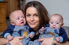 The smallest twins rescued in Britain (PHOTO)