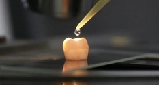 Ученые нашли способ восстановления зубной эмали (ИНФОГРАФИКА)