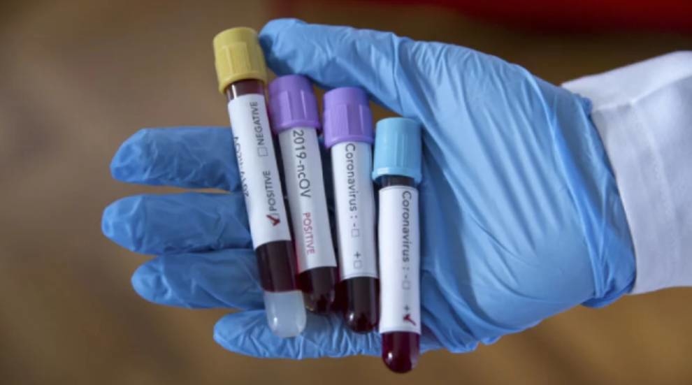 Новий тест на коронавірус «працює» до 10 разів швидше — вчені з США