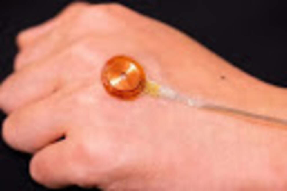 Scientists have come up with a tiny sensor that detects skin diseases