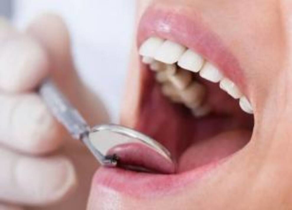 Чистить зубы, чтобы не было инсульта: новое открытие ученых